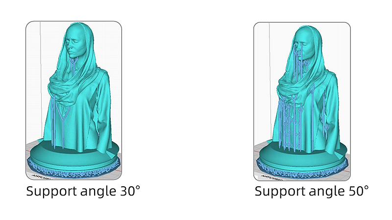 How to Add Support